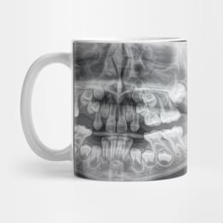 Dental x ray Mug